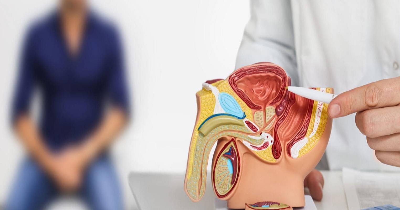 Male-infertility (1)